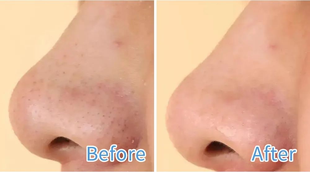 图片仅供参考，效果因人而异