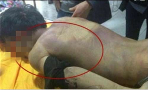 照片里死者背后大片的紫红色是尸斑