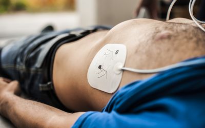 defibrillator electrode