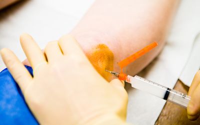 Cortisone injection