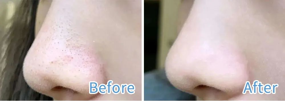 图片仅供参考，效果因人而异