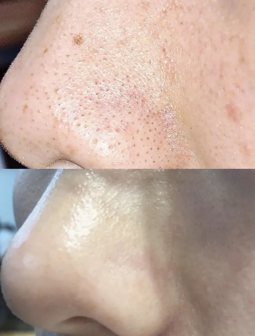 图片仅供参考，效果因人而异